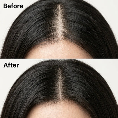 Korean Scalp Revival Bar sub