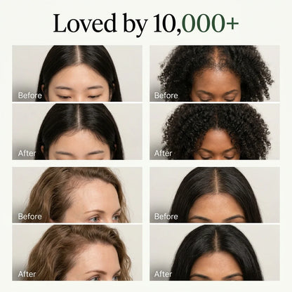 Korean Scalp Revival Bar sub